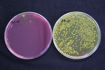 Bacteria image